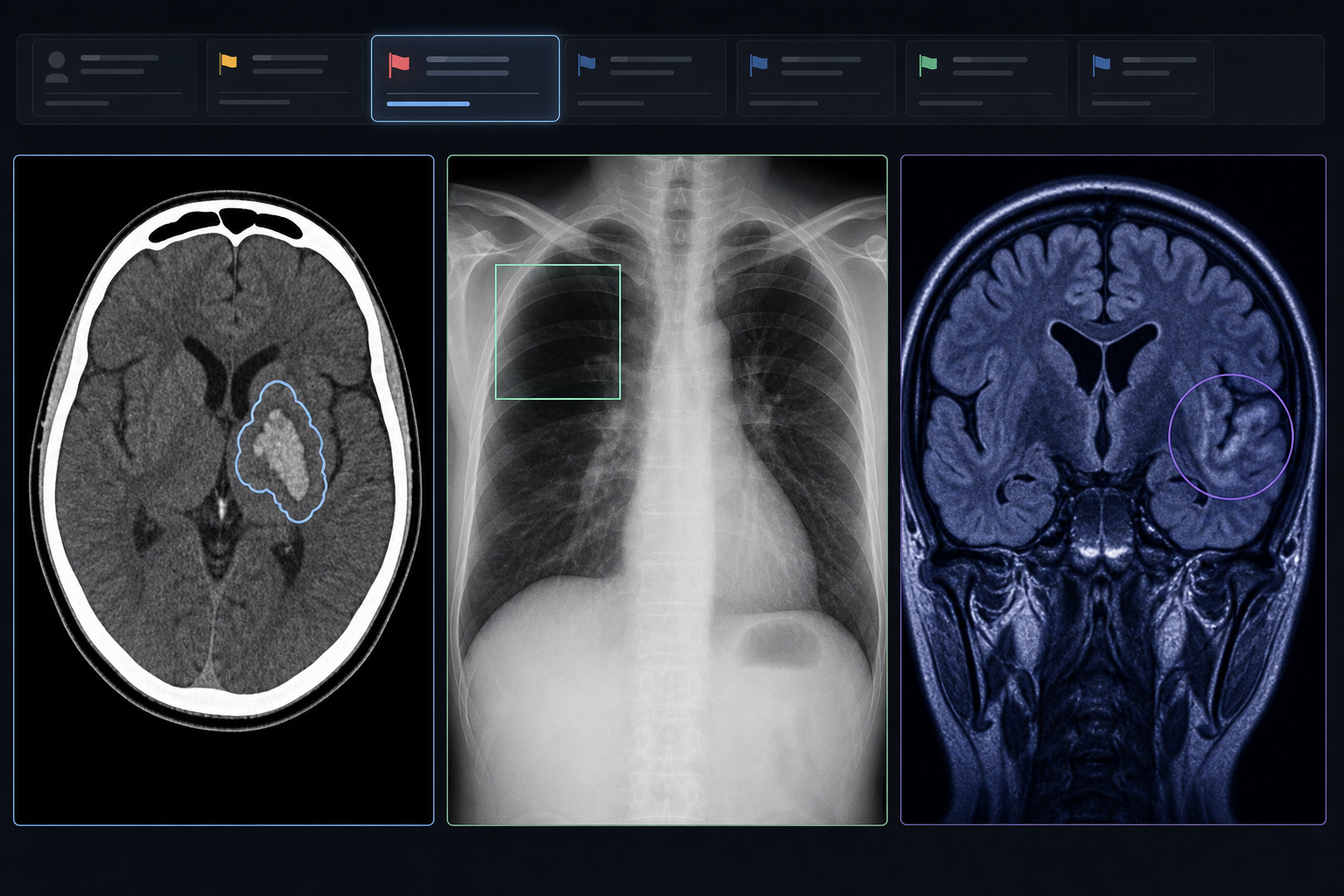 AI Triage in Radiology: CT, MRI, and Chest X-Ray Applications by Modality and Indication