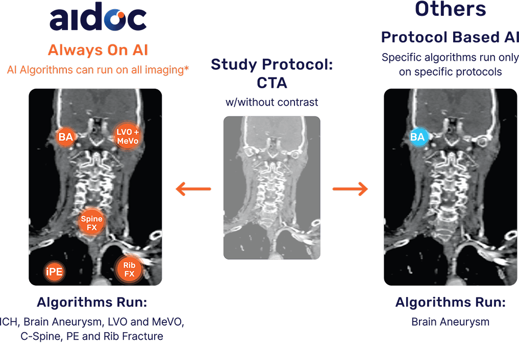 Aidoc aiOS clinical AI platform interface showing a radiology workflow dashboard with CT scan image views, patient case list with urgency flags, and AI-detected finding alerts.