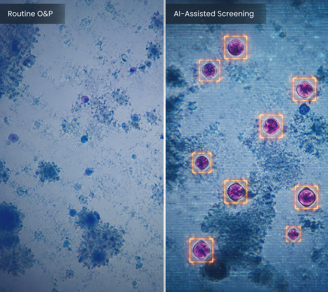 Split illustration comparing faint Cyclospora oocysts on routine O&P microscopy with AI-assisted screening that highlights suspicious oocysts