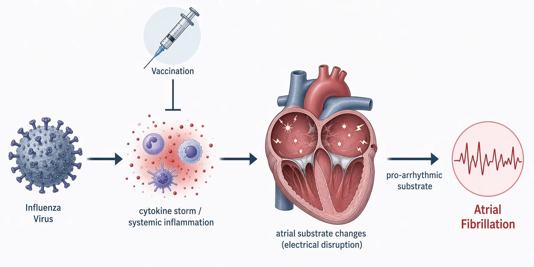 Clinical pathway from influenza infection through systemic inflammation to atrial fibrillation, interrupted by vaccination