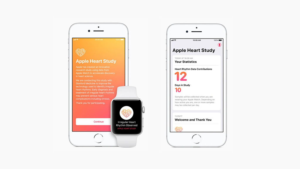 Apple Watch displaying ECG waveform and heart rate data in a clinical monitoring context
