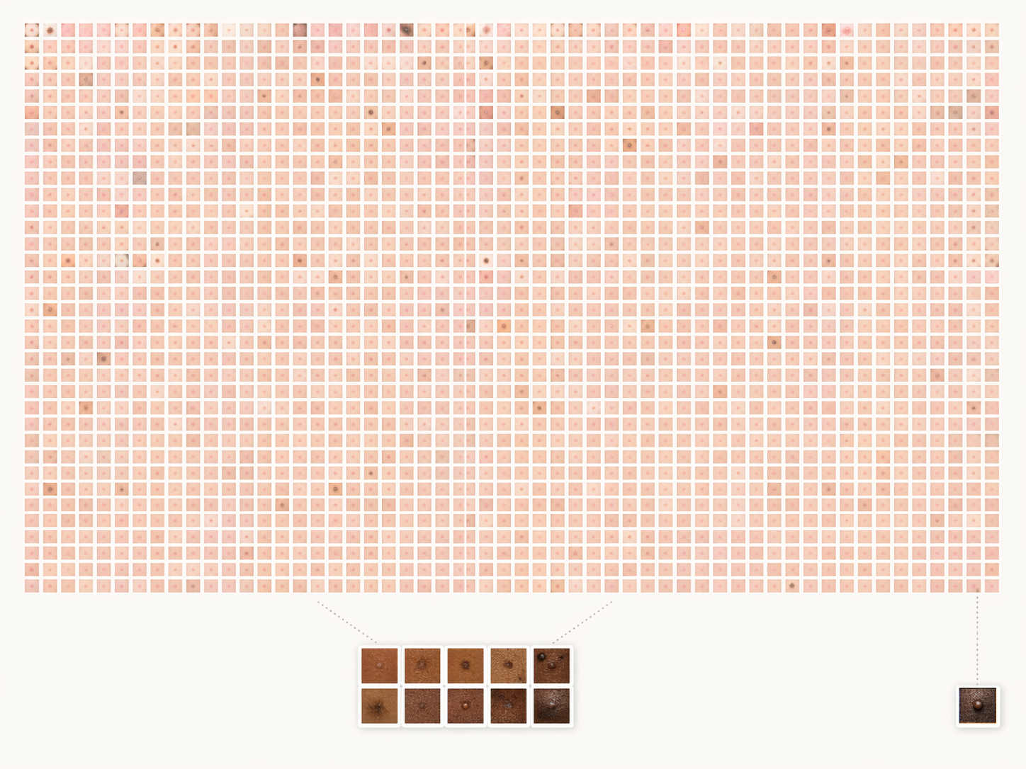 Grid of dermatology image thumbnails showing extreme underrepresentation of darker skin tones
