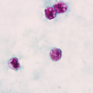 Cyclospora cayetanensis oocysts stained pink-red on modified acid-fast fecal smear