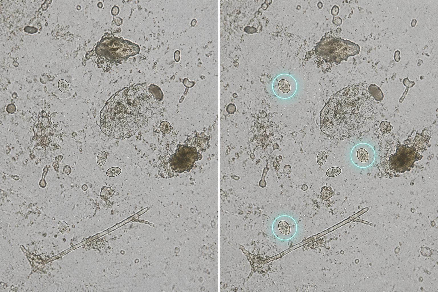 Split microscopy view with barely visible organisms on one side and highlighted organisms on the other