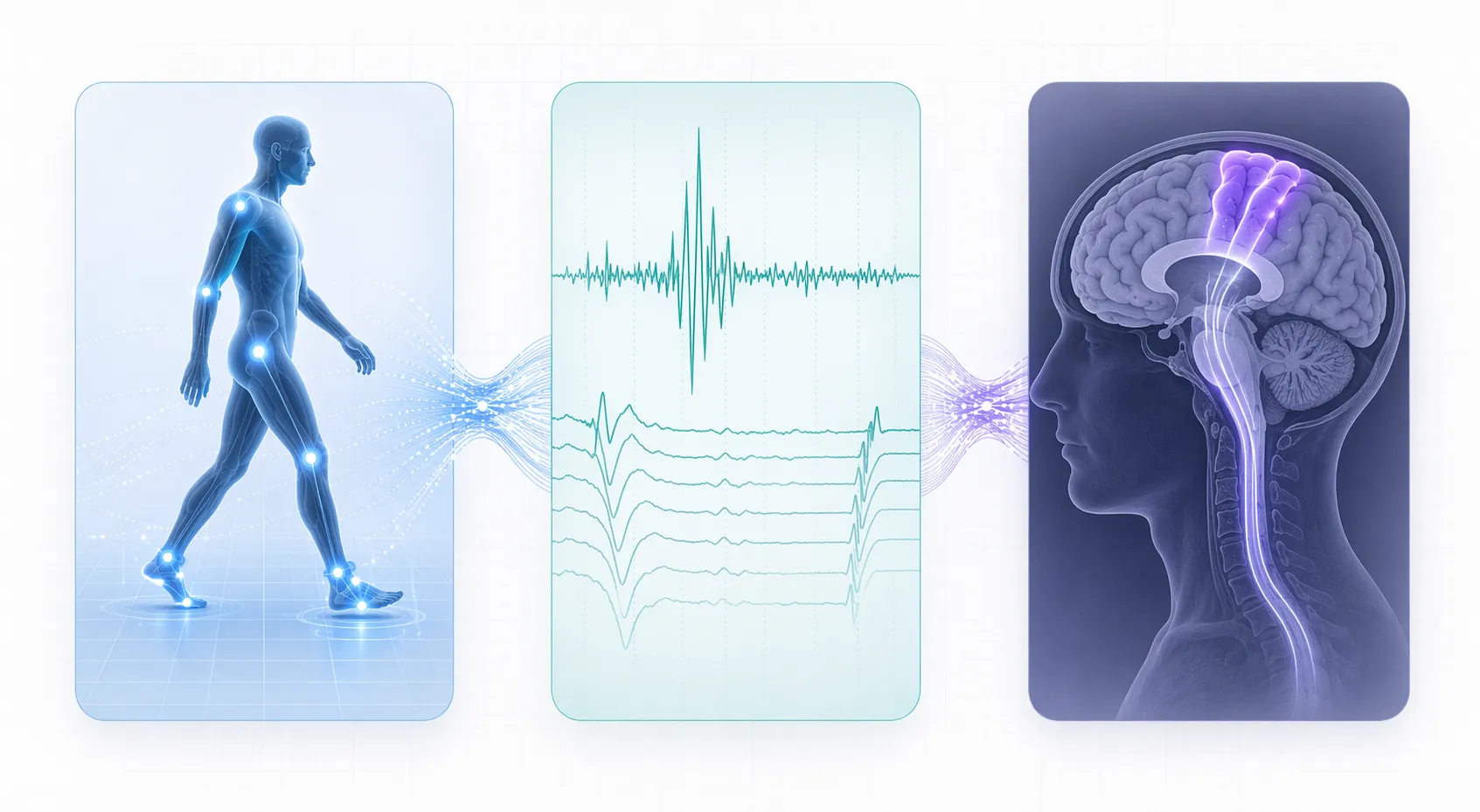Three-panel medical illustration of gait analysis, EMG waveform analysis, and MRI motor pathway analysis