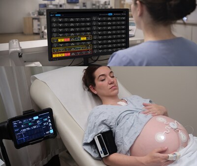 Sibel Health ANNE Maternal wireless monitoring sensors on abdomen and chest with vital sign data displayed on a mobile device