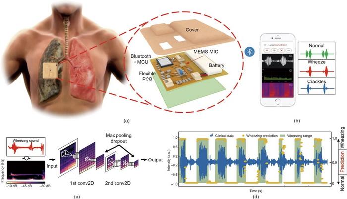 Wireless wearable stethoscope patch placed on a person's upper chest for lung sound monitoring