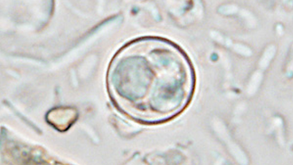 Cyclospora cayetanensis oocysts seen under a microscope from a CDC laboratory specimen