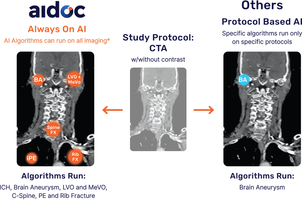 Aidoc aiOS clinical AI platform interface showing a radiology workflow dashboard with CT scan image views, patient case list with urgency flags, and AI-detected finding alerts.